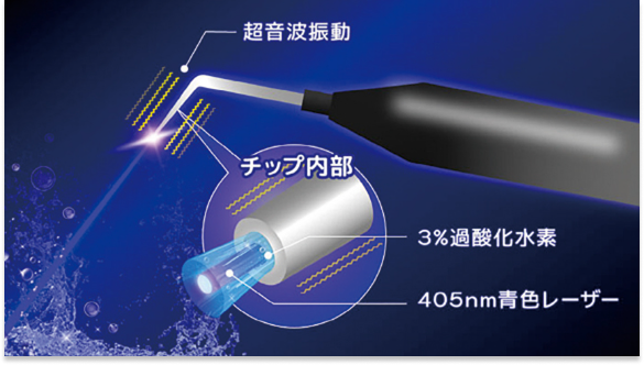 ブルーラジカル治療の仕組み2
