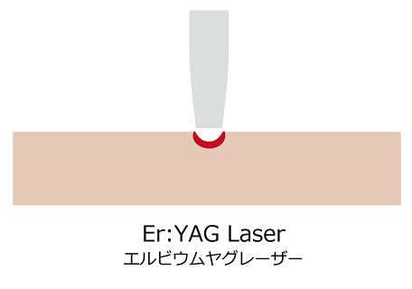 身体に負担がかからない歯周病治療 1