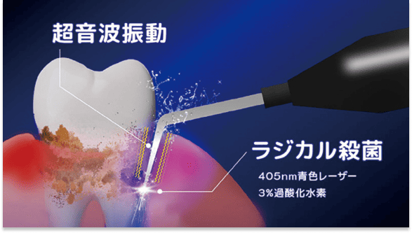 ブルーラジカル写真