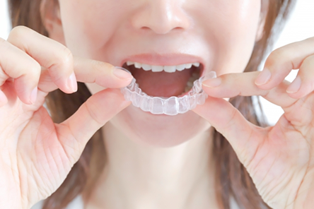 大人の矯正治療