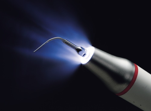 歯垢・歯石・バイオフィルムの除去