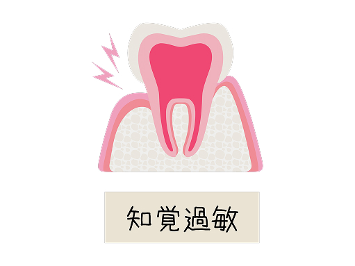 知覚過敏を引き起こす原因