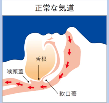 正常な気道