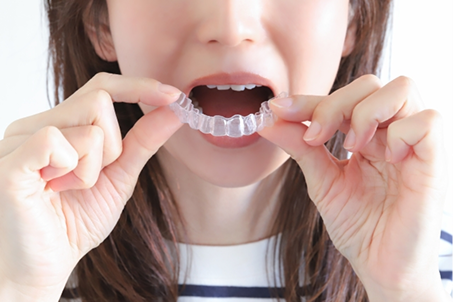 ホームホワイトニング