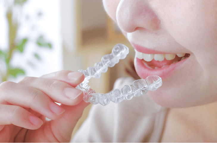 ホワイトニングがおすすめの方